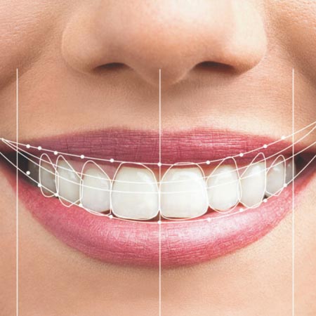 Digital smile scan