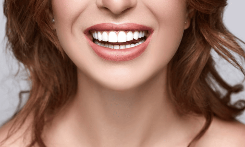 Full Mouth Reconstruction Treatment